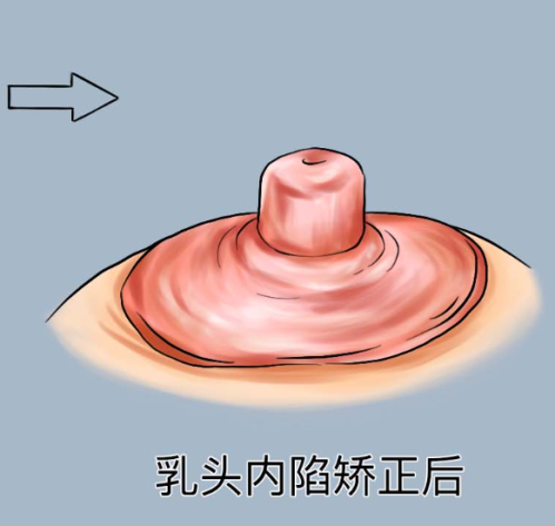 青岛滨海学院附属医院（医疗美容科）地址电话及营业时间：