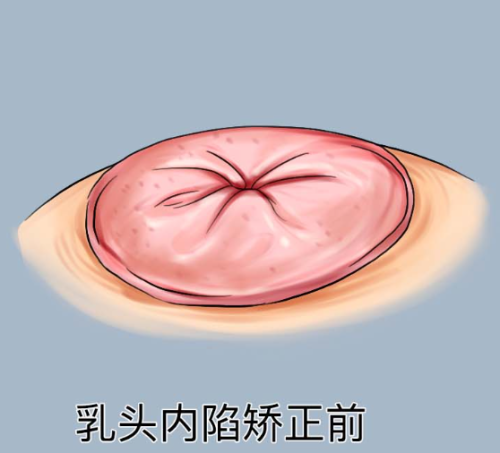 北京四季青橙门诊部正规吗？