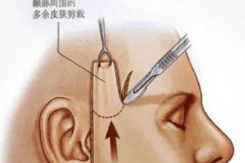 三、深圳洗纹身好的正规医院选择建议