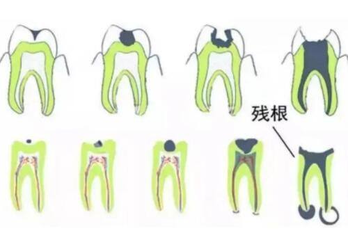 雅安鑫西华整形医院正规吗？