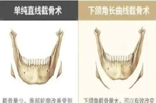 北京好年华医疗美容诊所收费价格表：