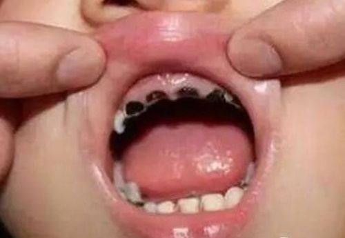 商丘交通医院中韩口腔口碑如何？