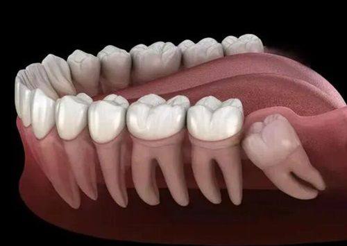 一、西安交大口腔医院挂号预约三大方式
