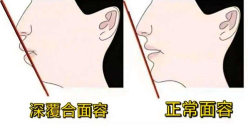 二、深圳穗华口腔地址地铁接驳方案