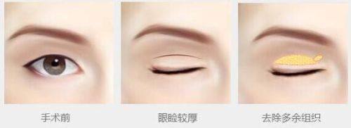 北京四季青橙门诊部医生介绍：