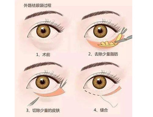 北京四季青橙门诊部特色项目：