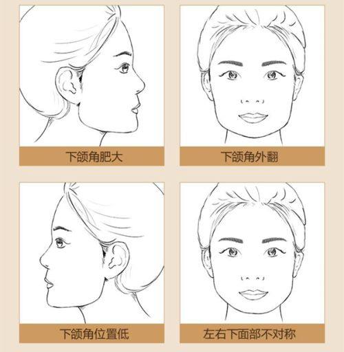 深圳美诗沁医疗美容门诊部预约挂号方式：