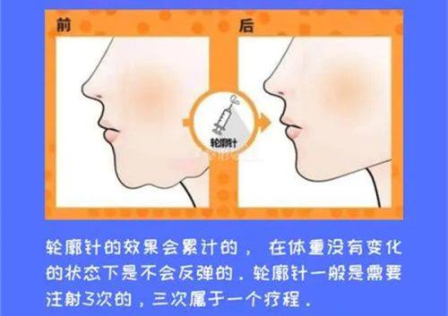 三、2025年赣州植发医院选择指南