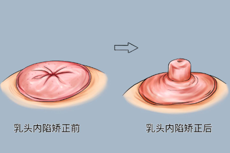 深圳非凡医疗美容医院