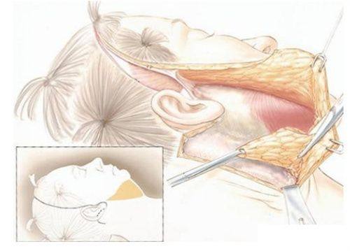 3. 西安叶子医院脱毛之服务体验优势