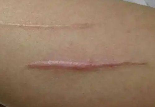 东莞非凡整形美容医院特色项目：