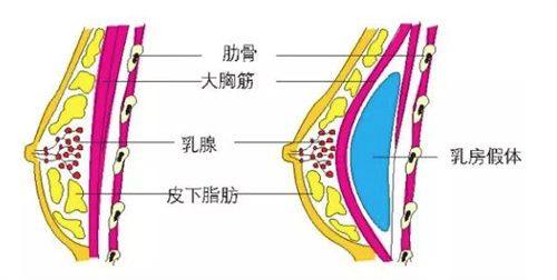 2. 亲历辽宁曙光小腿吸脂之设备齐全优势