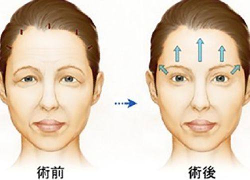 辽宁中 医 药大学附属第四 医院（医疗美容科）地址电话及营业时间：