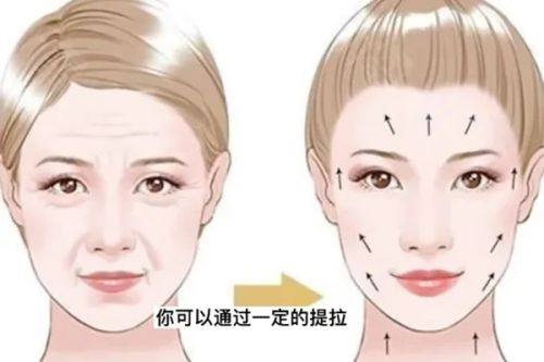东莞非凡整形美容医院正规吗？