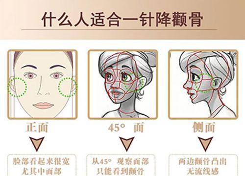 苏州美诗沁医疗美容诊所预约挂号方式：