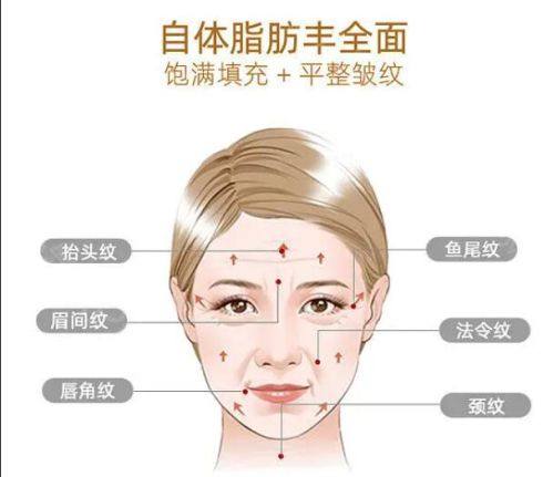 三、2025惠州整形医院热门项目价格参考