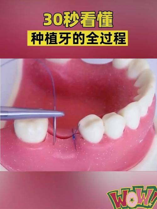 一、苏州美奥口腔价格表