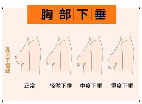 五、打了生长因子三年后疯长的预防措施