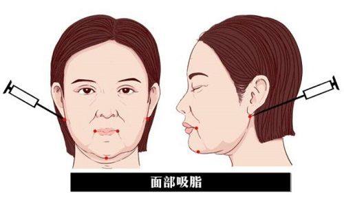 南宁华美整形医院怎么样？正规连锁资质+优质医生团队+合理价格，口碑获众多求美者认可！ 