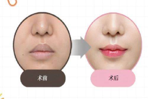 四、成都画美医疗美容医院正规吗——医生团队情况