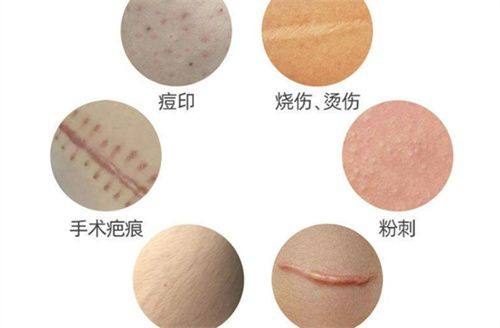 三、深圳非凡医疗美容医院口碑实例的真实呈现
