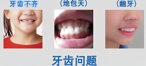 四、佛山曙光金子口腔的材料与学术方面有哪些优势