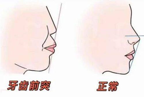 四、大连九诺口腔和康贝佳口腔哪个好？适合人群建议