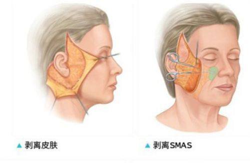 四、西安西美整形外科门诊部的技术水平