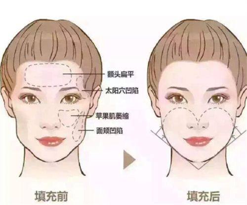 五、上海虹桥医院疤痕科的服务理念怎么样