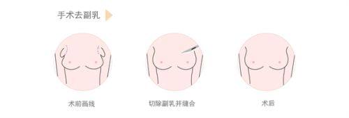 上海虹桥医院疤痕科怎么样？总结