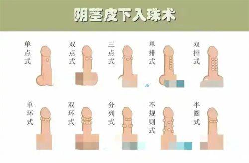 二、深圳非凡医疗美容医院口碑医生的技术解码