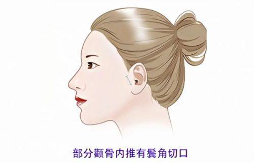 二、上海虹桥医院疤痕科的医疗团队怎么样