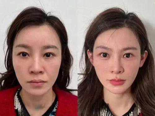 北京新星靓医疗美容医院口碑如何？