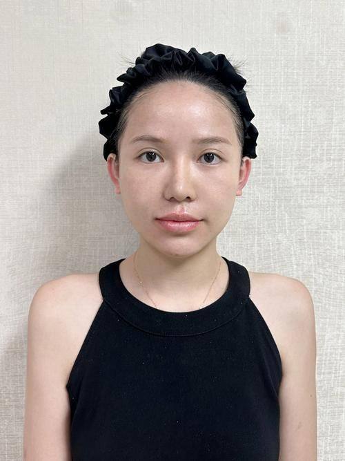 北京新星靓医疗美容医院收费价格表：