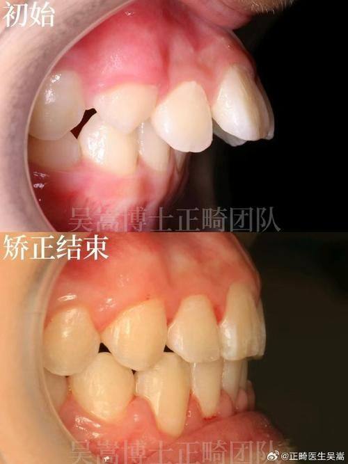德州宁津贝壳口腔诊所特色项目：