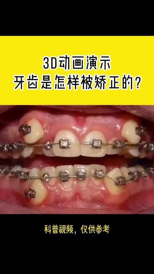 二、龙岩优梨口腔怎么样？