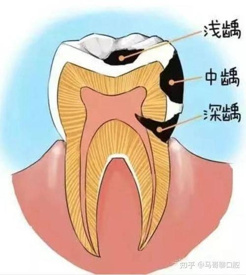一、金华市莱蒽口腔诊所价格表