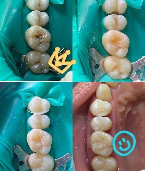 重庆云阳众植博仕口腔门诊部地址电话及营业时间：