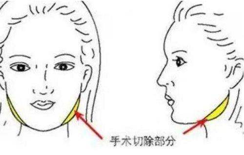 总结：河南漯河缔莱美属于什么档次？