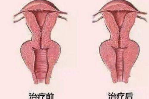 杭州米兰柏羽医疗美容医院特色项目：