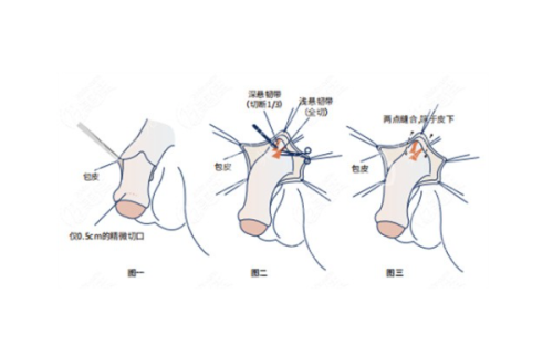 五、如何预约彭涛医生