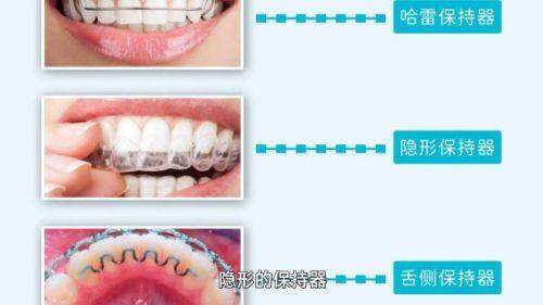 4. 深圳格伦菲尔口腔烤瓷牙方便就医