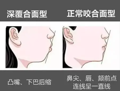 4. 洛阳维乐口腔树脂补牙——优质的服务体验