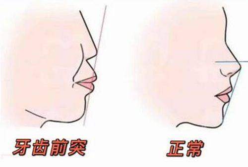 4. 威海中诺口腔金属自锁托槽矫正：优质服务提升体验