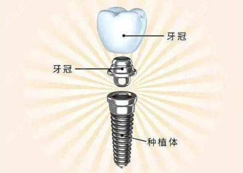 2. 洛阳维乐口腔树脂补牙——专精医生团队