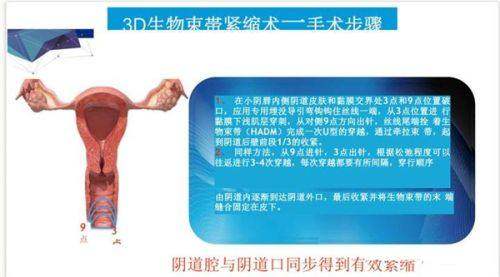 杭州米兰柏羽医疗美容医院地址电话及营业时间：