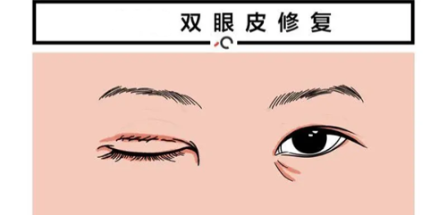 三、杭州医院皮肤科骨干医生号彭建中与吸脂医生彭涛技术对比