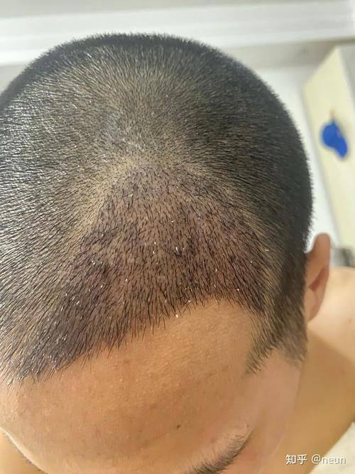 南京新生植发医疗美容门诊部