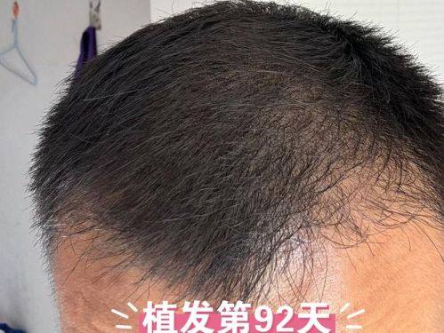 南京新生植发医疗美容门诊部正规吗？