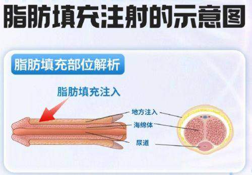 杭州艺星整形价格表2025年度总结